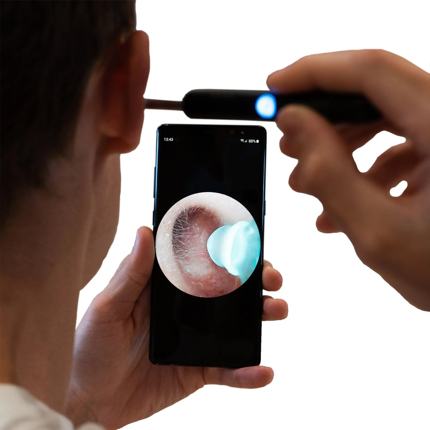 ACME ESSENTIALS™ - EAR WAX REMOVER PRO