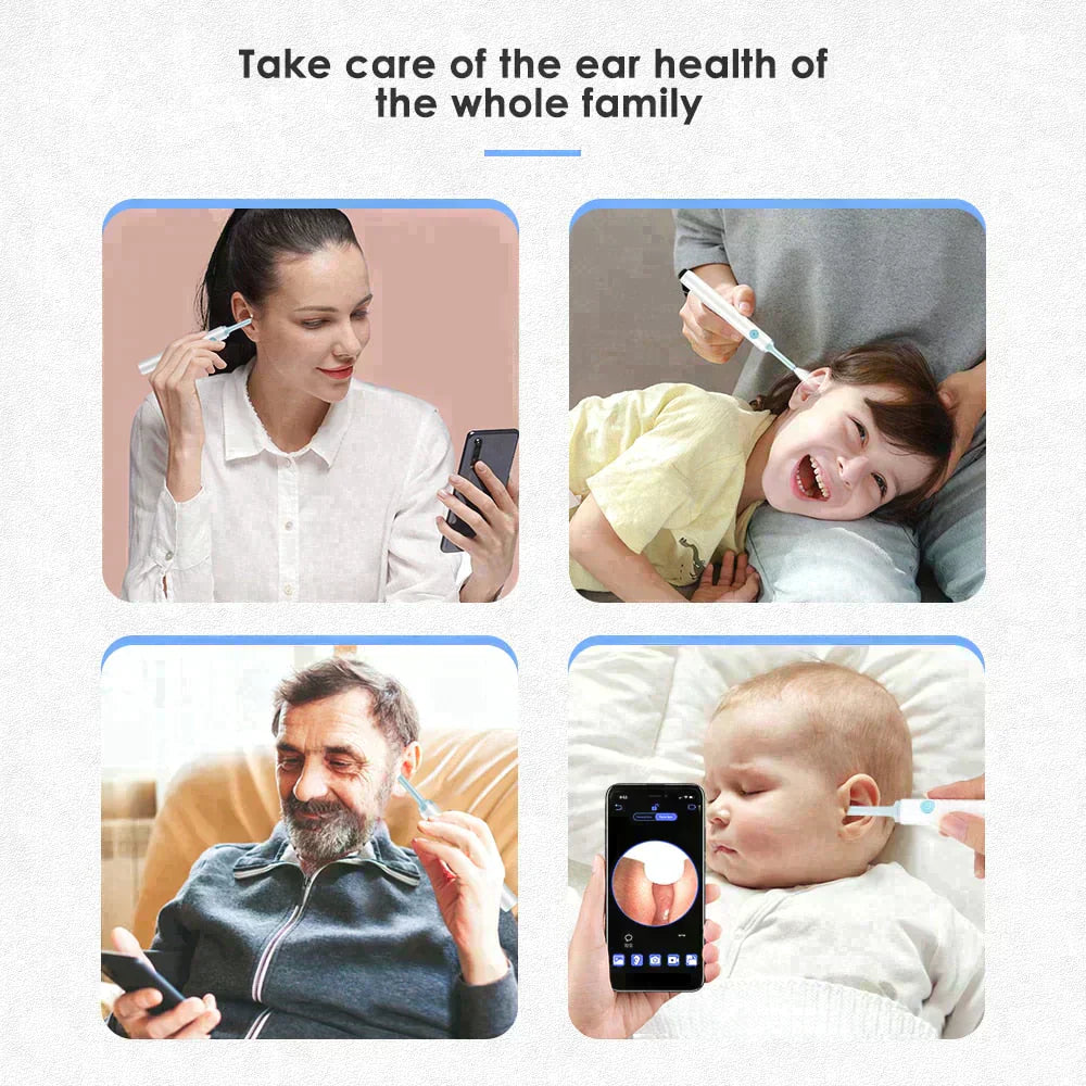 ACME ESSENTIALS™ - EAR WAX REMOVER PRO
