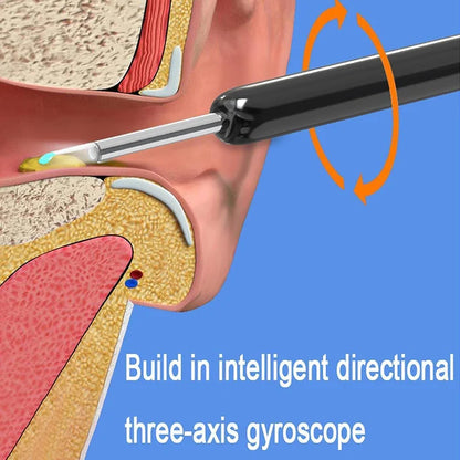 ACME ESSENTIAL™ - EAR WAX REMOVAL TOOL WITH CAMERA